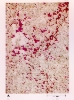 photo micrograph A