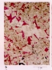 photo micrograph D