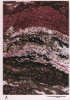 photo micrograph A